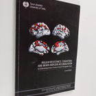 Laura Ekblad : Insulin resistance, cognition, and brain a... - pikkukuva 1