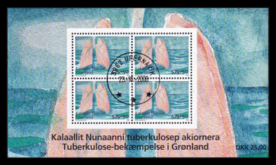 Grönlanti 511BL41 o Tuberkuloosi (2008)