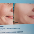 EELHOE Protein Lift Line Skin Kollageeni silkkilangat - pikkukuva 3