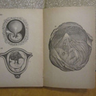 ALICE B STOCKHAM : Tokologia (1898), kätilökirja - pikkukuva 4